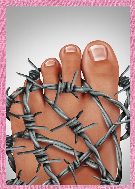 How to Cure Plantar Fasciitis in one week!