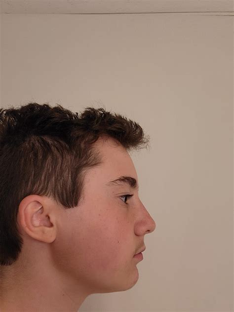 Does my side profile pass? Self conscious about lack of brow ridge