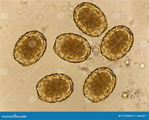 Verme Em Fezes Humanas - Ovo De Ascaris Lumbricoides (verme Redondo) Em Fezes Humanas Imagem de ...