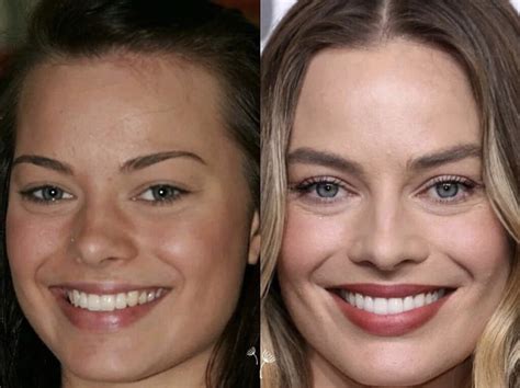 familiar smiles celebrities    teeth  july