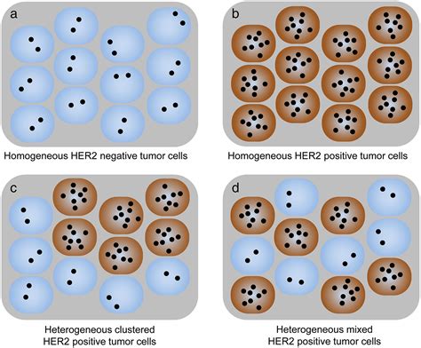 assessment   status  breast cancer    present