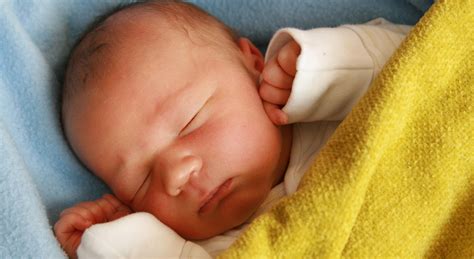 Bebê Com Icterícia Dorme Muito - Olhos De Bebe Com Ictericia