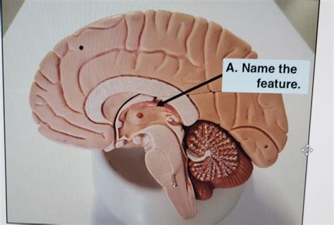 The brain stem The brain stem | Chegg.com