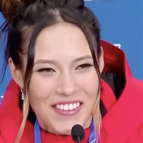 kaylee hartung eye injury 6