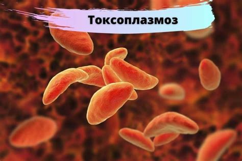 Токсоплазмоз: что такое, симптомы, опасность при беременности, лечение ...