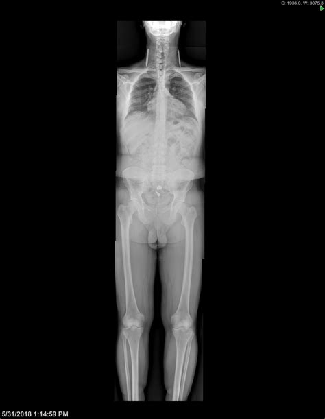 Musculoskeletal Imaging Case Review Series 5