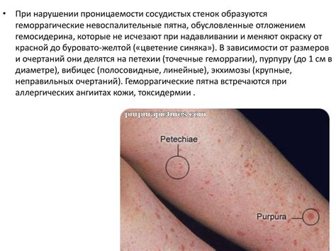 Морфологические элементы кожи - презентация онлайн