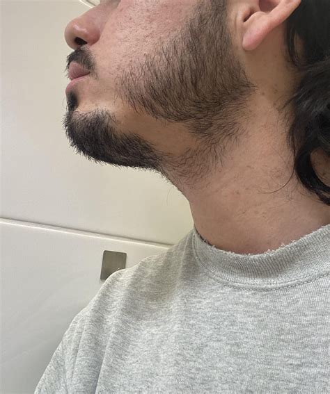 DermatologyQuestions | Got Skin Problems? Get Answers.