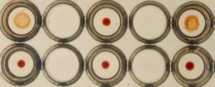 TPHA e VDRL – scheda microbiologica di approfondimento