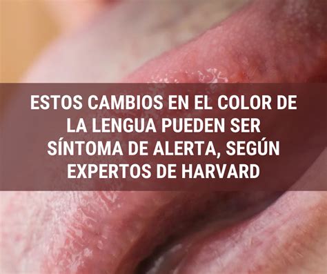 estos cambios en el color de la lengua pueden ser sintoma de alerta