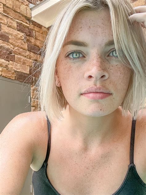 Tell me you have a billion freckles without telling me you have a