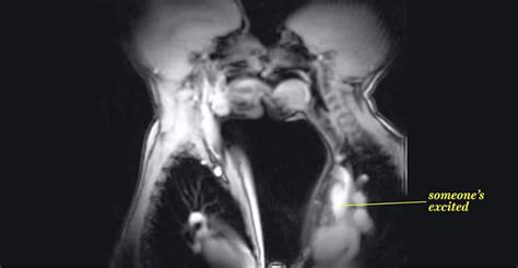 sex      footage   mri scanner