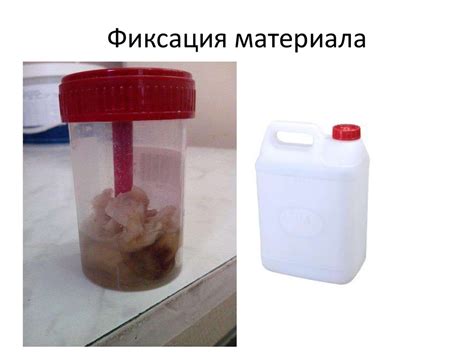Гистологическая техника. Приготовление гистологического препарата ...