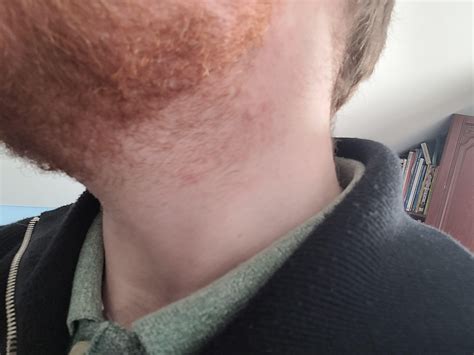 neck hair 7