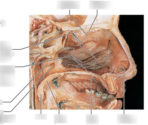 NASAL CAVITY: PHOTO * Diagram | Quizlet