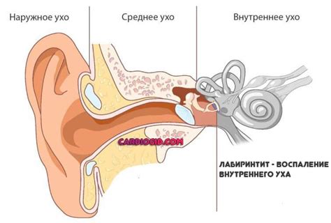 Лабиринтит: симптомы и лечение