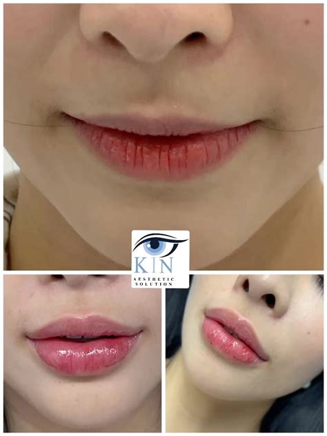 beautiful lips  give  beautiful smile   beautiful smile