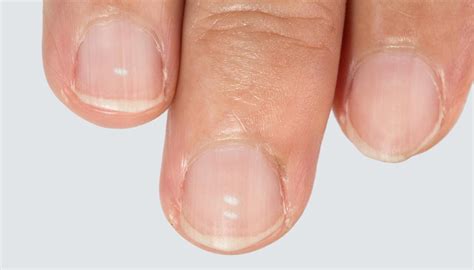 white bit   nail clear  minh boser blog