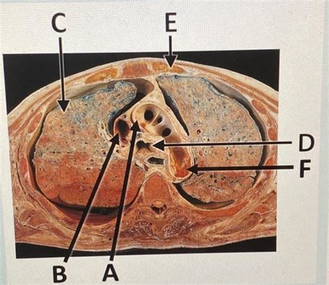 solved label  diagram