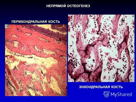 Презентация на тему: "СТРОЕНИЕ, РАЗВИТИЕ И РЕГЕНЕРАЦИЯ КОСТНОЙ ТКАНИ ...