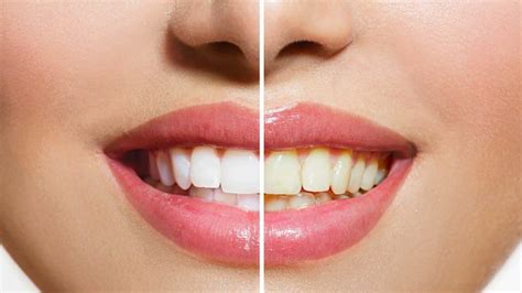 Como Ficar Mais Branca - 34 Ideias de Como Ficar Branco Naturalmente e Clarear a Pele