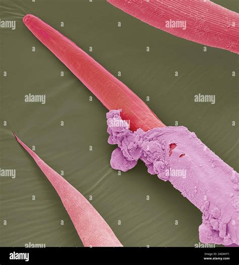 Phasmarhabditis hermaphrodita. Farbige Scanning Electron Micrograph ...