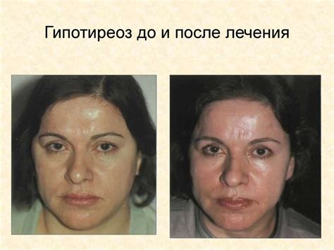 Наружный осмотр - online presentation