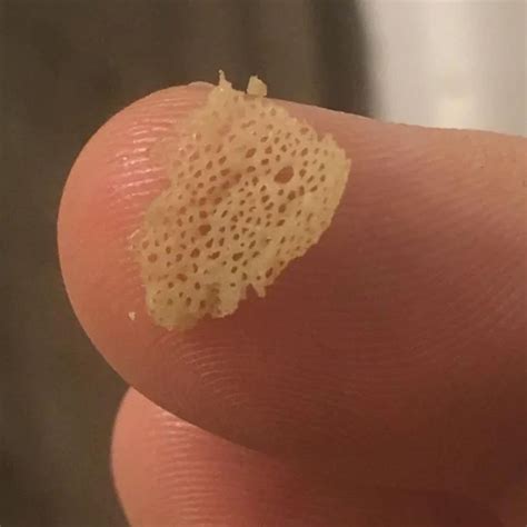 Lotus Pod Holes In Skin