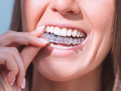 Protect Your Retainers | Oyster Orthodontics | Mobile Orthodontist