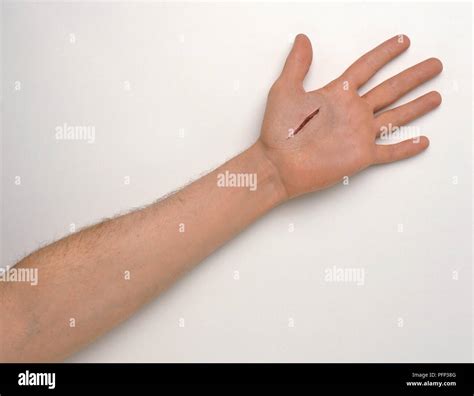 Deep cut on palm of hand Stock Photo - Alamy