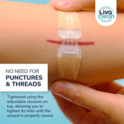 zip strips wound closure device ct  aid kit steri strips