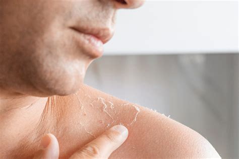 facts  sun damage qrxlabs