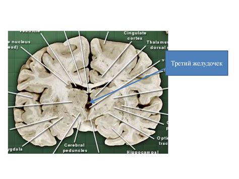 Таламус. Ядра таламуса - online presentation