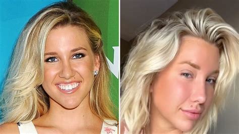 Savannah Chrisley Plastic Surgery: Transformation Photos | Life & Style