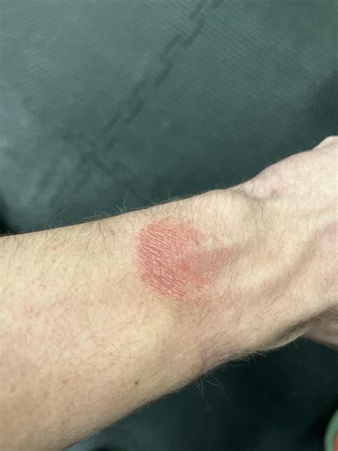 2022 Garmin forerunner 955 burning my wrist? : r/Garmin