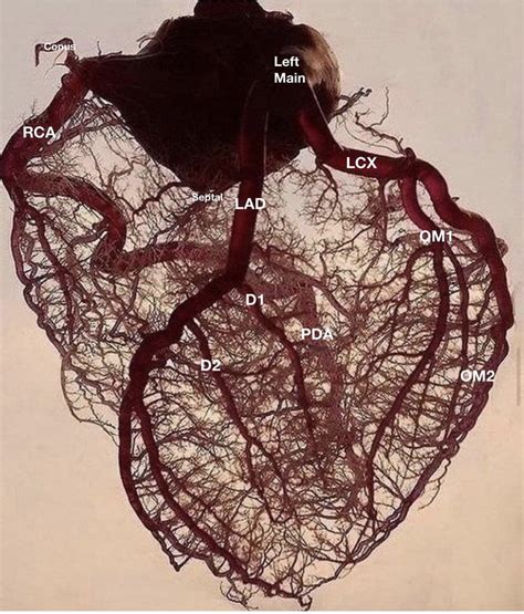 A 66-year-old male presented to the emergency department with acute