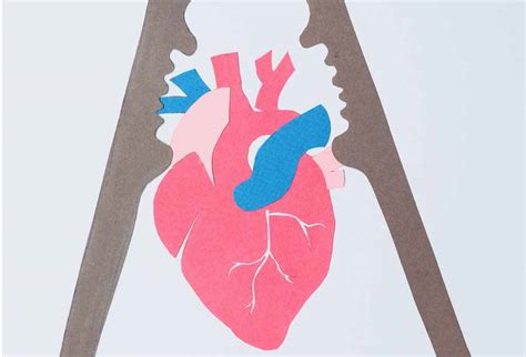 vasospasm klarity health library