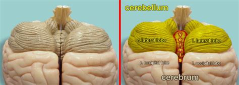 vermis is found in which of the following brain structure cerebrum me ...