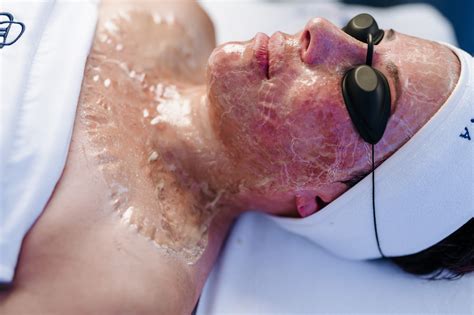 Anti-Aging Solutions I GLO Beauty Bar | Firming Peptide Facial