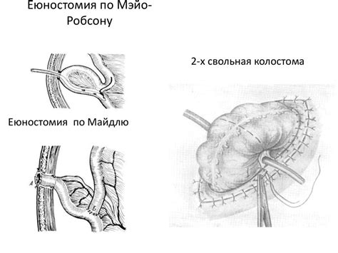 Хирургия желудка и кишечника - презентация онлайн