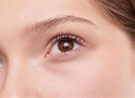 Dry Eye Syndrome | Dr. Sarah Avila