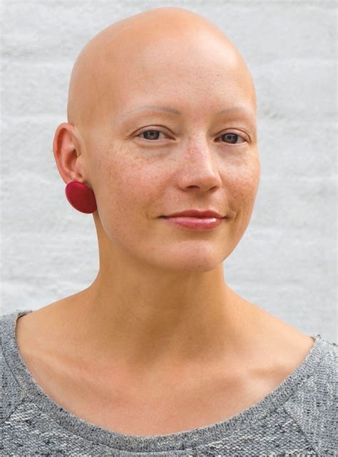 "Why I Love Being Bald" | Bald women, Bald girl, Lost hair