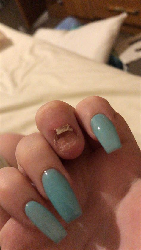 Why Are My Acrylics Popping Off at Sharon Lyons blog