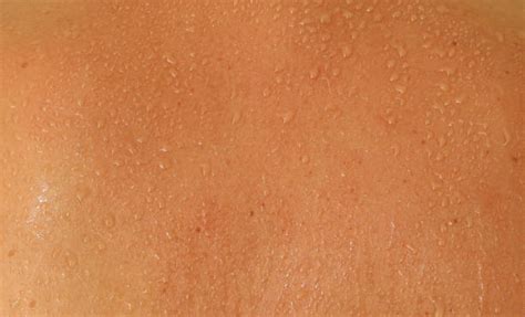 390+ Sweaty Skin Texture Stock Photos, Pictures & Royalty-Free Images ...
