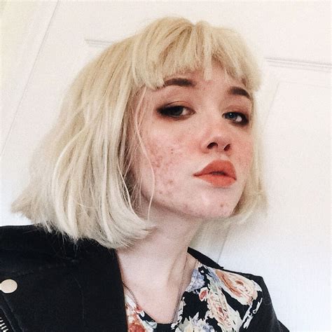 Ugly Girl Face Acne