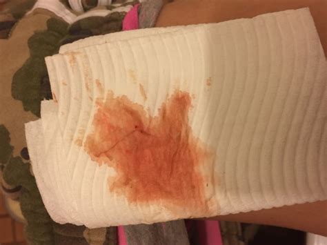 HELP!!! Period or implantation bleeding???? - Glow Community