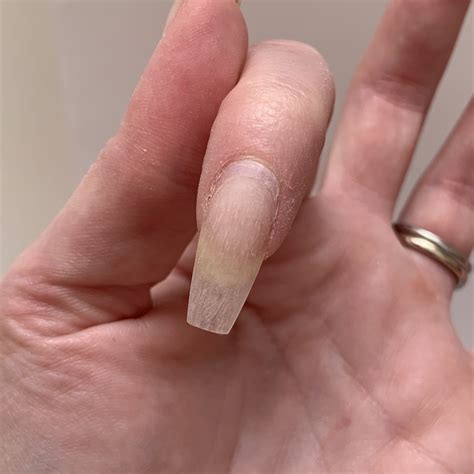 Lifting a hooked nail - Rebecca Orme Nail Pro