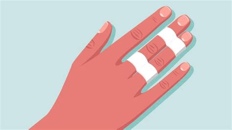 armdoc   buddy tape fingers  toes