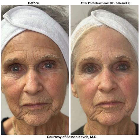 Alpha Medical Aesthetics - Medical Spa - Las Vegas, NV