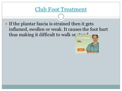 Club foot treatment